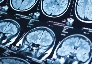 Хлорпирифос и болезнь Паркинсона: как пестициды уничтожают мозг