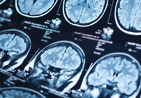 Хлорпирифос и болезнь Паркинсона: как пестициды уничтожают мозг