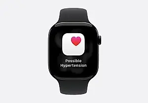 Apple Watch теперь сможет обнаруживать гипертонию: как это работает и зачем нужно