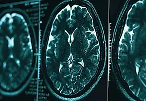 El cerebro vuelve a dibujar el mapa