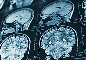 La huella de la infancia en el cerebro