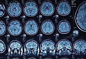 Las cinco fases del cerebro: no es tan sencillo