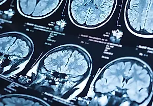 El cerebro como mapa anatómico: ¿es distinto el cerebro de los enfermos mentales «peligrosos»?