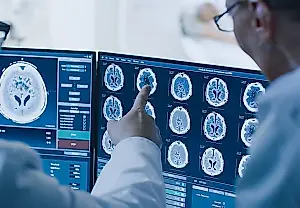 Impulsividad adolescente e ideas suicidas: el cerebro contra la cartera