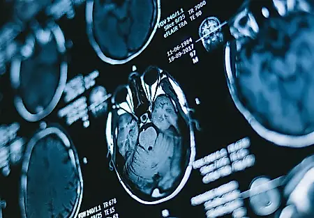 La guerra cambia la relación entre el apego infantil y el cerebro