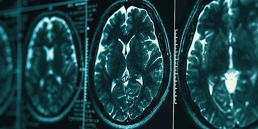 El cerebro vuelve a dibujar el mapa