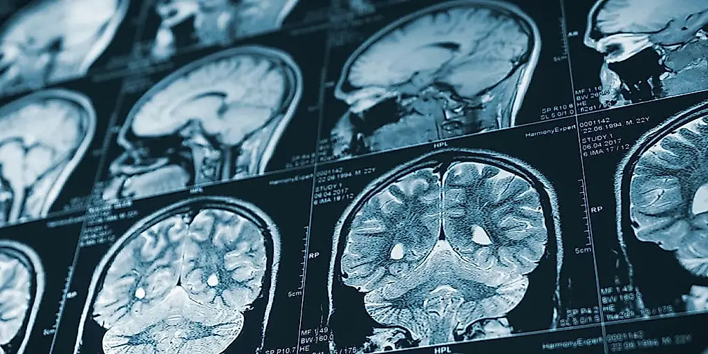 La huella de la infancia en el cerebro