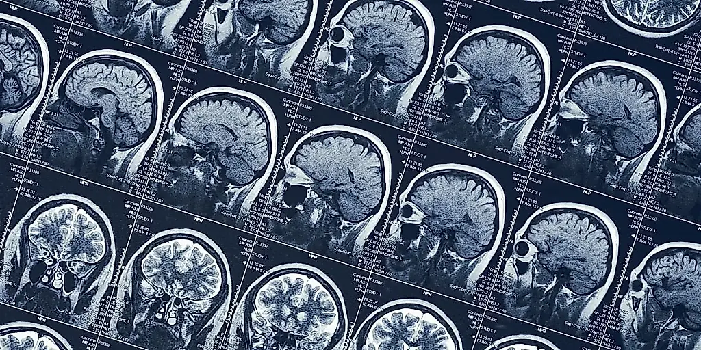 Psychopathy and brain anatomy: what scientists found in scans of prisoners