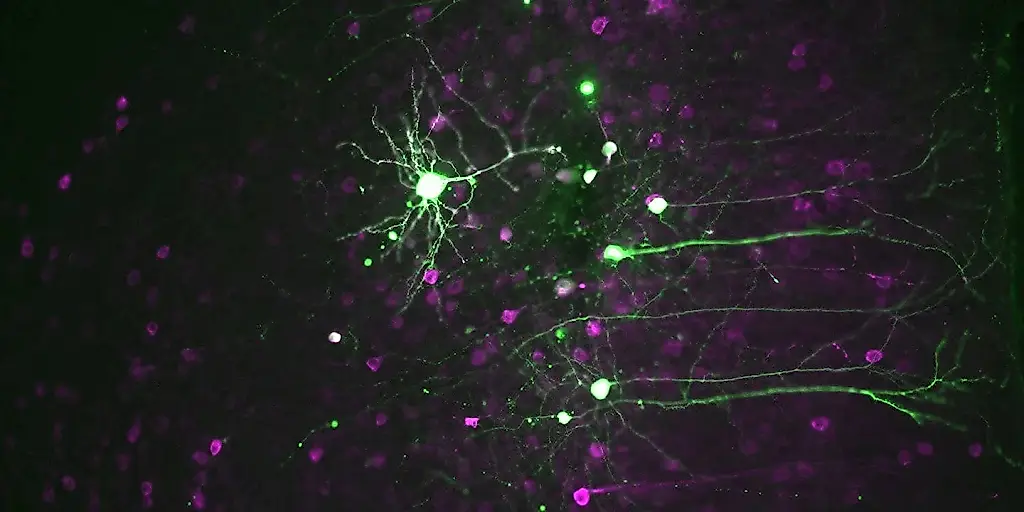 El cerebro activa el modo «a trabajar»