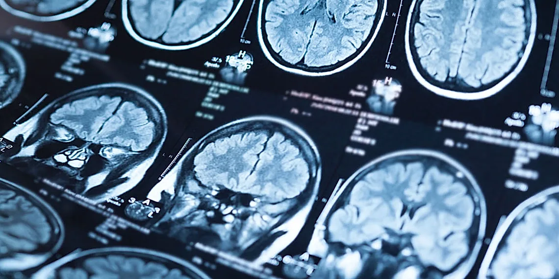 Хлорпирифос и болезнь Паркинсона: как пестициды уничтожают мозг